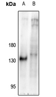 1 - Anti-NFAT1 (Phospho-S326) Antibody AP61143