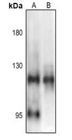1 - Anti-NF-kappaB p105 (Phospho-S903) Antibody AP61144