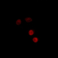 3 - Anti-Progesterone Receptor (Phospho-S400) Antibody AP61145