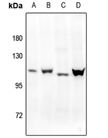 1 - Anti-Progesterone Receptor (Phospho-S400) Antibody AP61145