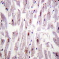 19 - Anti-c-RAF (Phospho-S621) Antibody AP61146