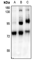 1 - Anti-c-RAF (Phospho-S621) Antibody AP61146
