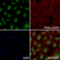 3 - Anti-Thymidine Kinase 1 (Phospho-S13) Antibody AP61147