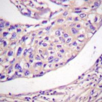 19 - Anti-Thymidine Kinase 1 (Phospho-S13) Antibody AP61147