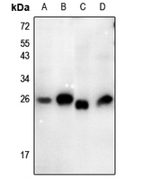1 - Anti-Thymidine Kinase 1 (Phospho-S13) Antibody AP61147