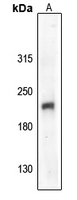 1 - Anti-VEGFR2 (Phospho-Y1059) Antibody AP61148