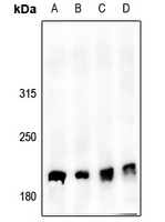 1 - Anti-53BP1 (Phospho-S6) Antibody AP61149