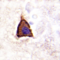 19 - Anti-Beta-2 Adrenergic Receptor (Phospho-S355/S356) Antibody AP61150
