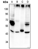 1 - Anti-Beta-2 Adrenergic Receptor (Phospho-S355/S356) Antibody AP61150