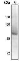 1 - Anti-Androgen Receptor (Phospho-S94) Antibody AP61151
