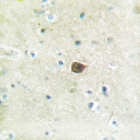 19 - Anti-PKC mu (Phospho-S205) Antibody AP61152
