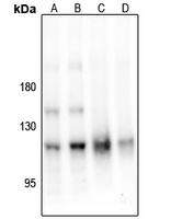 1 - Anti-PKC mu (Phospho-S205) Antibody AP61152