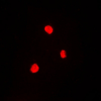 3 - Anti-RB1 (Phospho-T821) Antibody AP61153