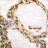 19 - Anti-RB1 (Phospho-T821) Antibody AP61153
