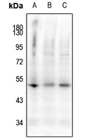 1 - Anti-Caspase 9 (Phospho-S144) Antibody AP61154