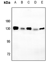 1 - Anti-CD130 (Phospho-S782) Antibody AP61155