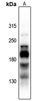 1 - Anti-L1CAM (Phospho-S1181) Antibody AP61156