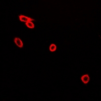 3 - Anti-CD226 (Phospho-S329) Antibody AP61157