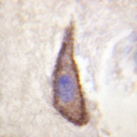 19 - Anti-CD226 (Phospho-S329) Antibody AP61157