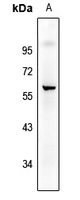 1 - Anti-CD226 (Phospho-S329) Antibody AP61157