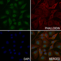 3 - Anti-CD115 (Phospho-Y561) Antibody AP61159