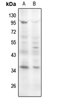 1 - Anti-Cyclin D1 (Phospho-S90) Antibody AP61160