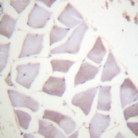 19 - Anti-Alpha-crystallin B (Phospho-S59) Antibody AP61161
