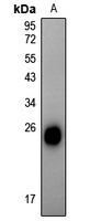 1 - Anti-Alpha-crystallin B (Phospho-S59) Antibody AP61161