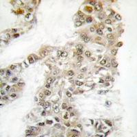 19 - Anti-DNA-PKcs (Phospho-S2056) Antibody AP61162
