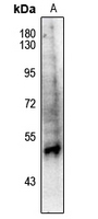 1 - Anti-PPAR alpha (Phospho-S21) Antibody AP61163