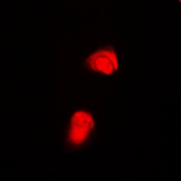 3 - Anti-SMAD2 (Phospho-T220) Antibody AP61164