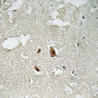 19 - Anti-SMAD2 (Phospho-T220) Antibody AP61164