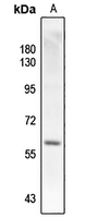 1 - Anti-SMAD2 (Phospho-T220) Antibody AP61164