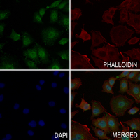 3 - Anti-SMAD3 (Phospho-S208) Antibody AP61165