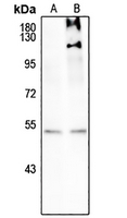 1 - Anti-SMAD3 (Phospho-S208) Antibody AP61165