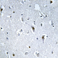 19 - Anti-HMGN2 (Phospho-S29) Antibody AP61166