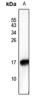 1 - Anti-HMGN2 (Phospho-S29) Antibody AP61166