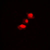 3 - Anti-hnRNP D0 (Phospho-S83) Antibody AP61167