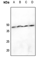 1 - Anti-hnRNP D0 (Phospho-S83) Antibody AP61167