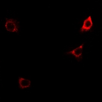 3 - Anti-CD124 (Phospho-Y497) Antibody AP61168