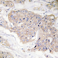 19 - Anti-CD124 (Phospho-Y497) Antibody AP61168