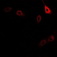 3 - Anti-CD127 (Phospho-Y449) Antibody AP61169