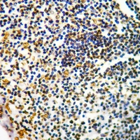 19 - Anti-CD127 (Phospho-Y449) Antibody AP61169