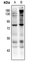 1 - Anti-CD127 (Phospho-Y449) Antibody AP61169