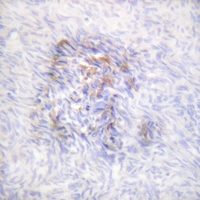 19 - Anti-Aconitase 1 (Phospho-S138) Antibody AP61170