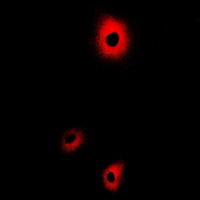 3 - Anti-Beta-NaCH (Phospho-T615) Antibody AP61171