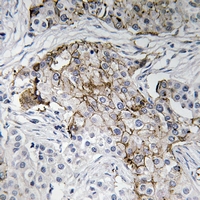 19 - Anti-Beta-NaCH (Phospho-T615) Antibody AP61171