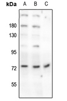 1 - Anti-Beta-NaCH (Phospho-T615) Antibody AP61171