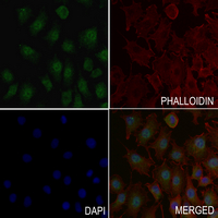 3 - Anti-Topoisomerase 2 alpha (Phospho-S1106) Antibody AP61172