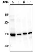 1 - Anti-Topoisomerase 2 alpha (Phospho-S1106) Antibody AP61172